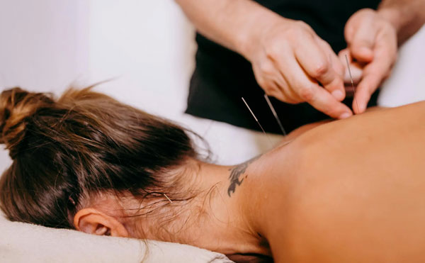 Akupunktur - Yvonne Weigl